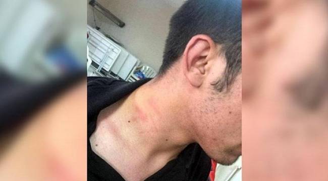 AK Partili milletvekili CHP'li gencin boğazını sıktı, daha sonra özür diledi