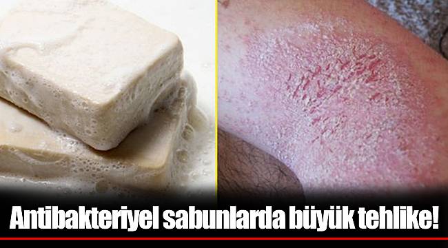 Antibakteriyel sabunlarda büyük tehlike!