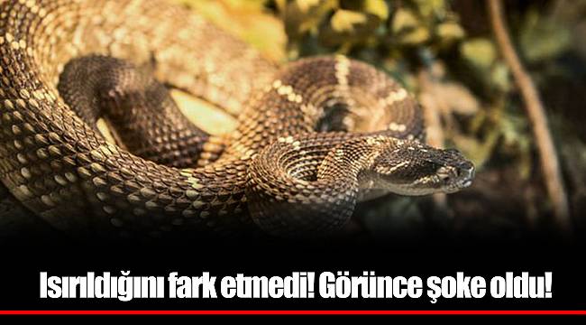 Isırıldığını fark etmedi! Görünce şoke oldu!