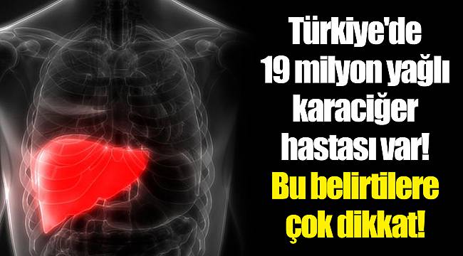 Türkiye'de 19 milyon yağlı karaciğer hastası var! Bu belirtilere çok dikkat!