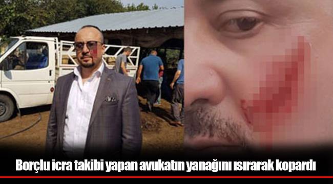 Borçlu icra takibi yapan avukatın yanağını ısırarak kopardı