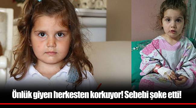 Önlük giyen herkesten korkuyor! Sebebi şoke etti!