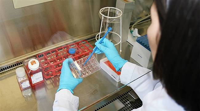 Alzheimer’da kök hücre çalışmaları ile gelen umut