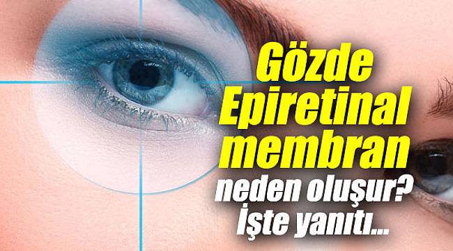 Epiretinal membran neden oluşur? İşte yanıtı...