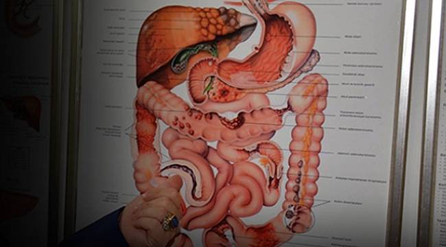 Hemoroid (Basur) nedir? Hemoroid nasıl geçer? Basur tedavi yöntemleri neler?