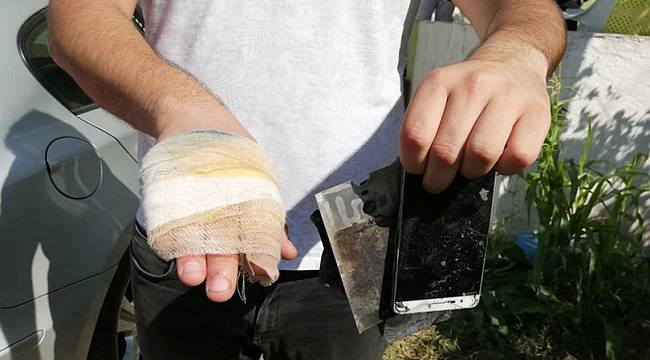 Patlayan cep telefonu yaraladı