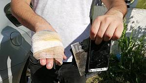 Patlayan cep telefonu yaraladı