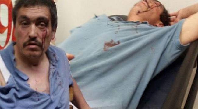 ‘Sen benim eşime bakıyorsun’ diyerek hastanelik etti