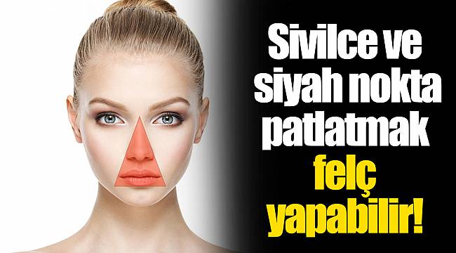 Sivilce ve siyah nokta patlatmak felç yapabilir!