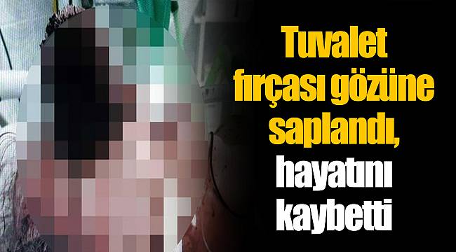Tuvalet fırçası gözüne saplandı, hayatını kaybetti
