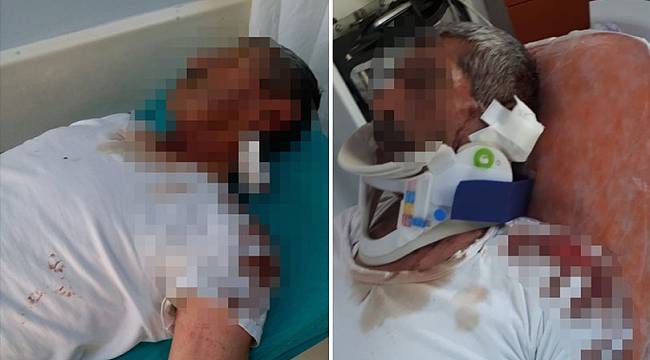 Van'da bir camide 'kulağımı ısırarak koparttı' iddiası