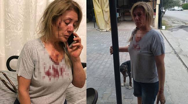 Balıksir'de köpeklerini gezdirirken dehşeti yaşadı!