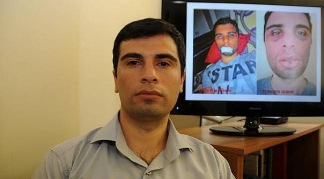 Bedavacılardan dayak yiyen güvenlik görevlisi isyan etti!