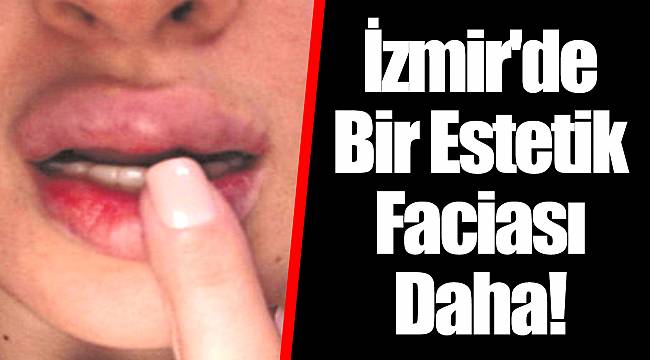 İzmir'de Bir Estetik Faciası Daha!