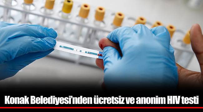 Konak Belediyesi’nden ücretsiz ve anonim HIV testi