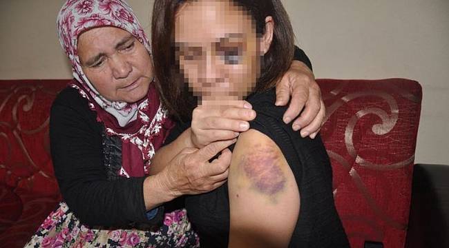 Boşanma davası açtı, koruma karar aldırdı yine de şiddetten kurtulamadı