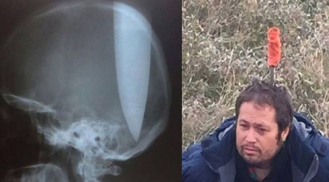 Kendi başını deldi! Sebebi ise şoke etti!