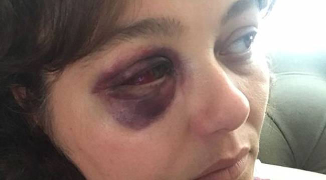 Restoranda yemek yiyen kadını yumruklayan zanlıya dava açıldı