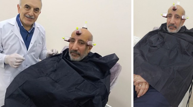 Abdurrahman Dilipak hacamat yaptırdı