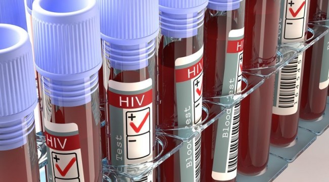 AIDS nedir? AIDS belirtileri nelerdir? AIDS nasıl bulaşır?
