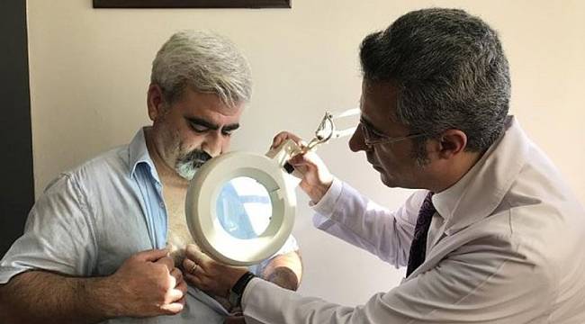 Bir sivilceyle başladı! Köpek memesi hastalığıyla yıllardır mücadele ediyor