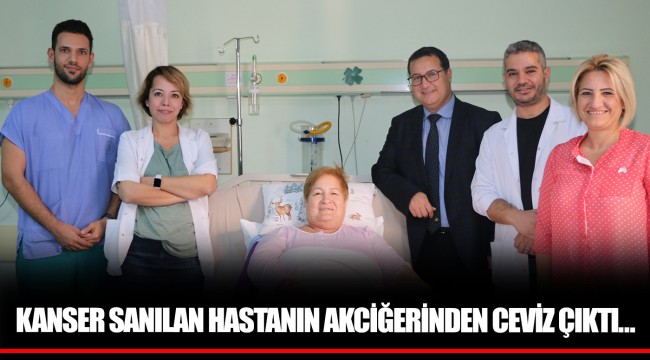 KANSER SANILAN HASTANIN AKCİĞERİNDEN CEVİZ ÇIKTI…