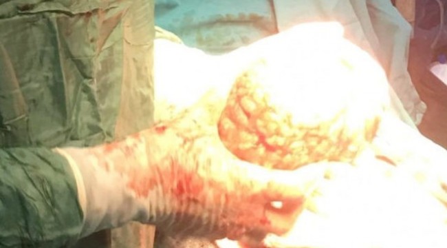 8 aylık hamile sandılar ama... Doktor 'ilk kez karşılaştım' dedi