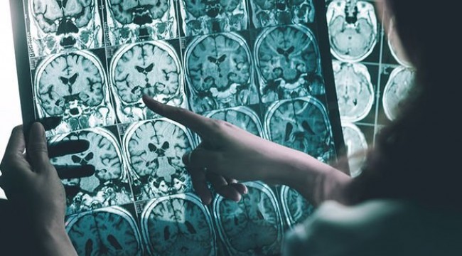 Alzheimer hastalarına ilaç olacak iki yosun türü bulundu