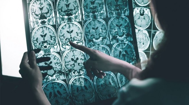 Alzheimer hastalarına ilaç olacak iki yosun türü bulundu
