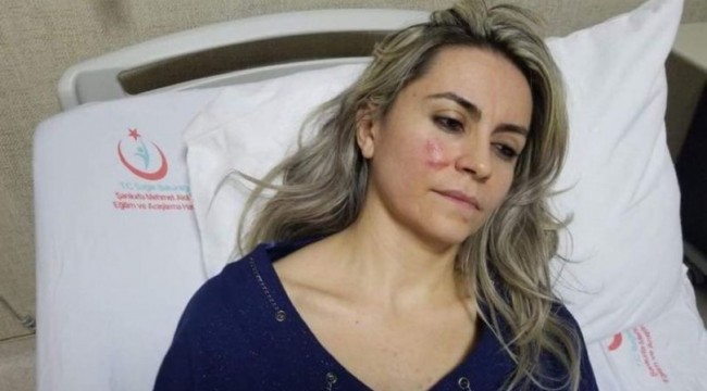 Çürük raporu vermeyen kadın doktoru darp etti!
