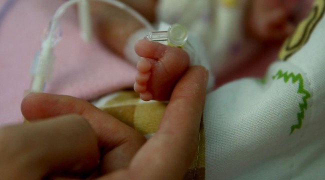 İyi sağlık hizmeti milyonlarca prematüre bebeği yaşatabilir