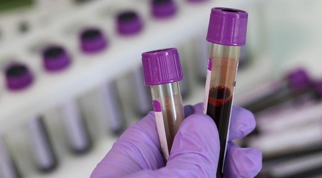 Talasemiyi önlemede yüzde 100 başarı hedefi