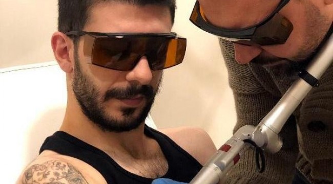 Dövmesini sildirmek isteyenler dikkat: Kalıcı hasarlara neden olabilir
