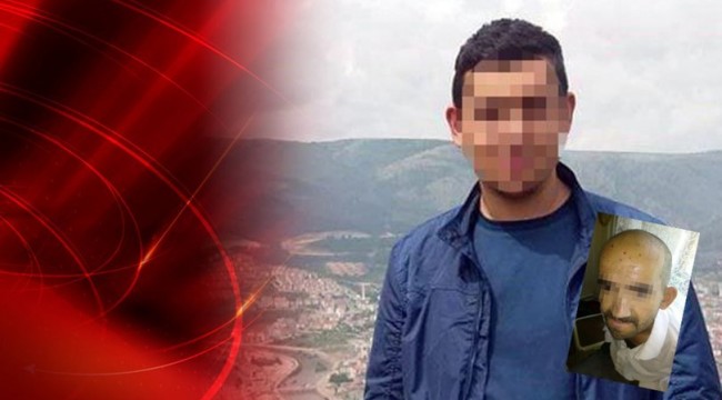 Engelli kişinin kafasında söndürülen sigara "silah" sayıldı