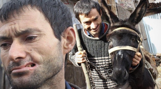 Eşek sahibinin yanağını parçaladı