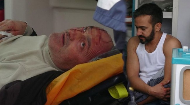 İETT otobüsünde akılalmaz tartışmada kan aktı