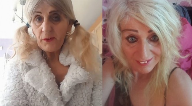 Melissa Ede piyangodan çıkan tüm parayı estetiğe harcadı!