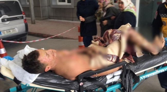 Terasta feci olay! Yaptığı hata sonu oluyordu