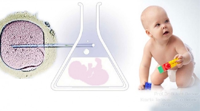 Tüp bebek tedavisi yapılması hastaları mutlu ediyor