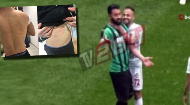 Amedsporlu Mansur Çalar'a ömür boyu men cezası