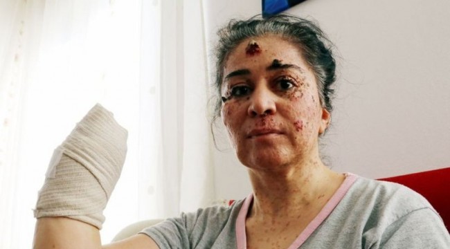 Güneşin erittiği kadının isyanı: Yaz gelsin hiç istemiyorum