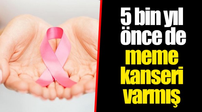 5 bin yıl önce de meme kanseri varmış