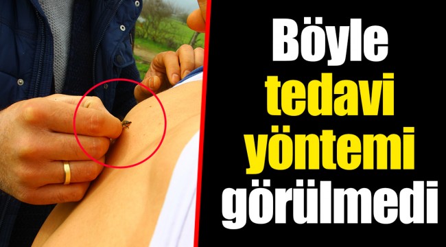 Böyle tedavi yöntemi görülmedi