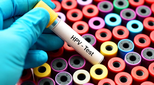 HPV testinin pozitif çıkması dünyanın sonu değil