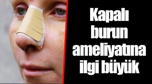 Kapalı burun ameliyatına ilgi büyük