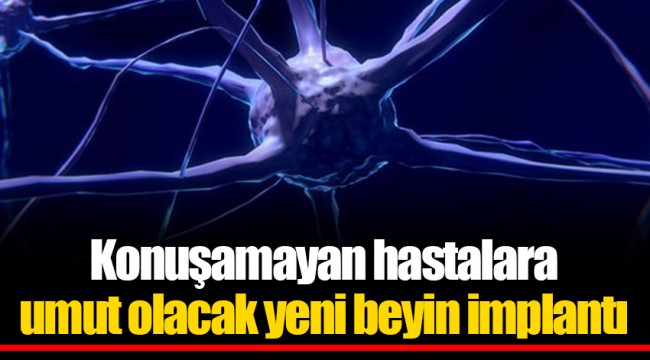 Konuşamayan hastalara umut olacak yeni beyin implantı