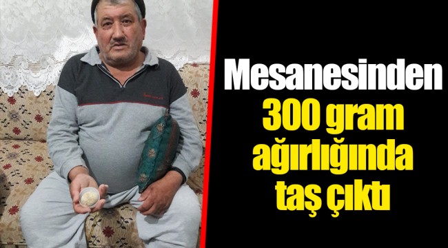 Mesanesinden 300 gram ağırlığında taş çıktı