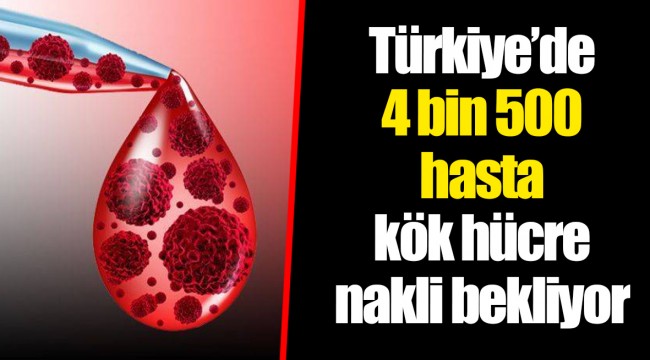 Türkiye’de 4 bin 500 hasta kök hücre nakli bekliyor