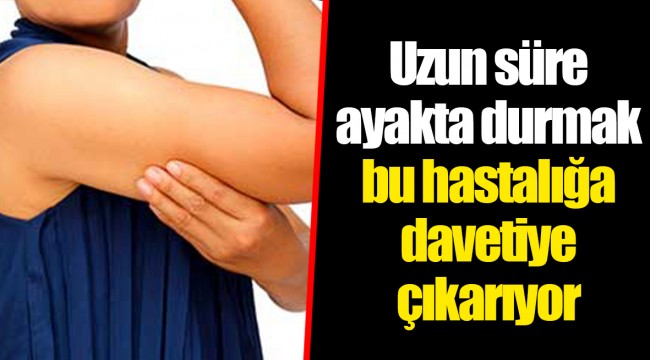 Uzun süre ayakta durmak bu hastalığa davetiye çıkarıyor