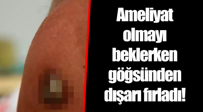 Ameliyat olmayı beklerken göğsünden dışarı fırladı!